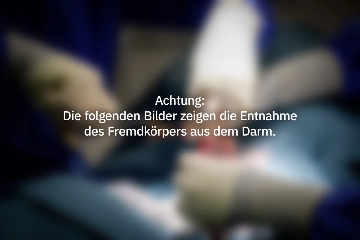 Warnung vor Bildern.